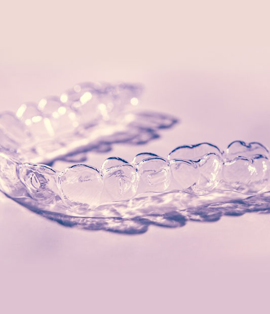 Clear dental aligners displayed on soft purple background, representing modern orthodontic treatment.