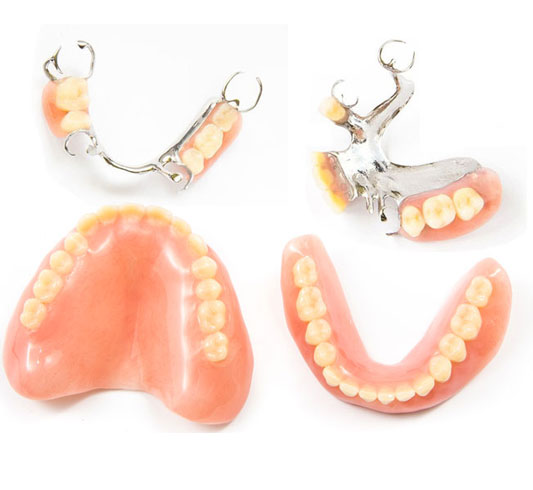 Removable partial dentures and denture components displayed against white background.