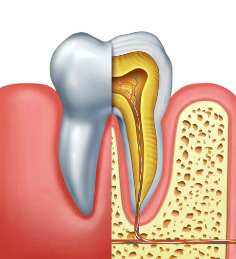 Cross-section diagram of tooth anatomy showing crown, root, pulp, and surrounding gum tissue.