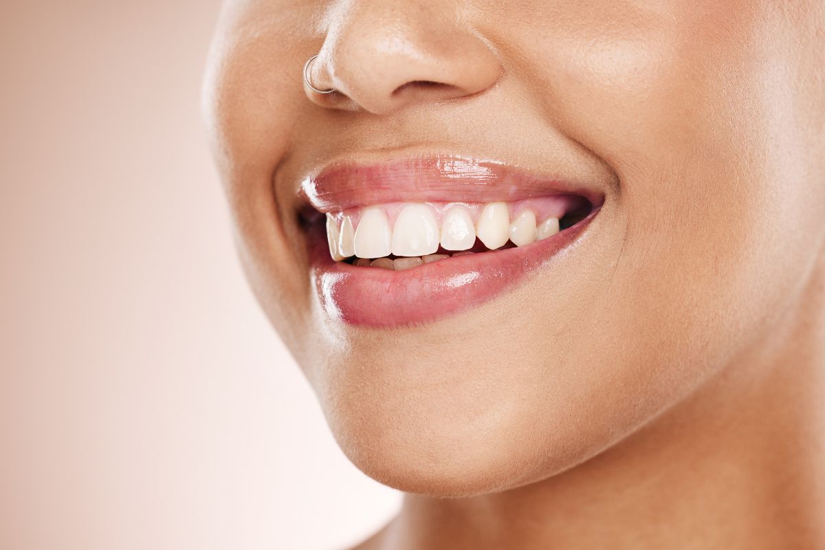 Featured image for “How Teeth Whitening Can Boost Your Confidence and Oral Health”