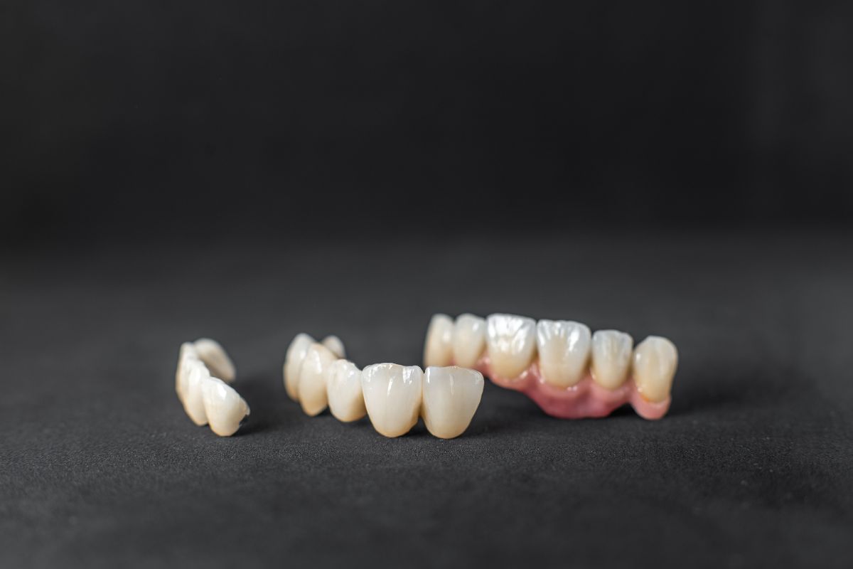Dental crowns and bridges displayed on a dark background.