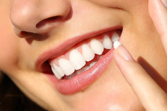 Close-up of person's bright white smile showing healthy teeth and natural complexion.