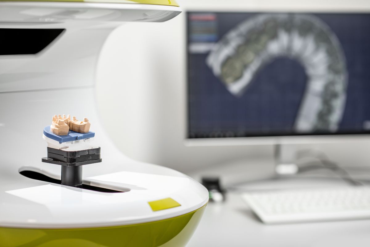 Featured image for “5 Advantages of CEREC Crowns Over Traditional Options”