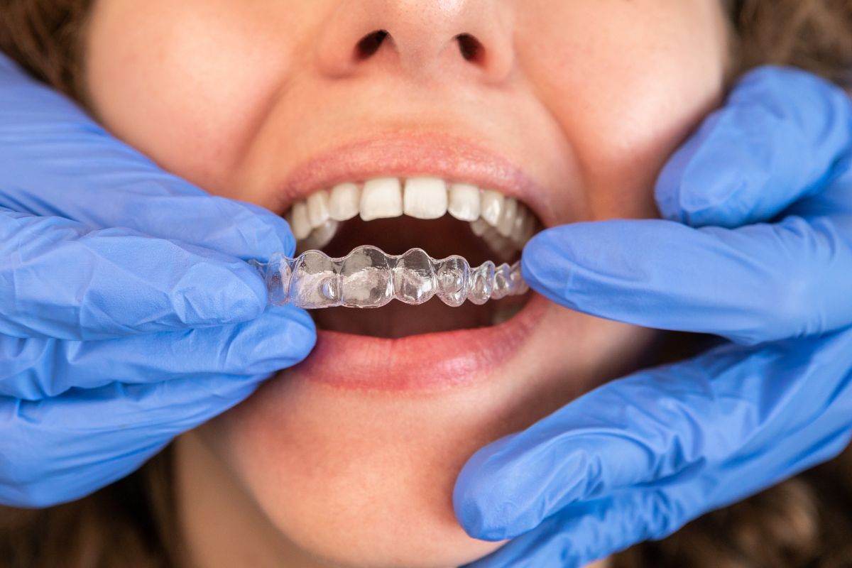 Featured image for “Why Invisalign Is a Great Option for Busy Professionals”
