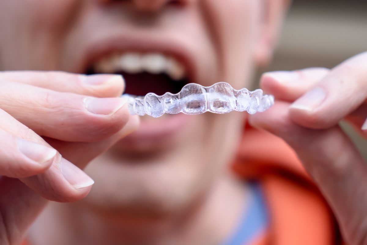 Featured image for “Common Mistakes to Avoid During Your Invisalign Treatment”